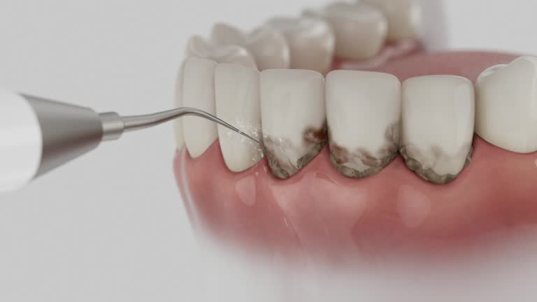 Reliable Dental Implants contractor in Burney, CA by Smile Center Dentistry